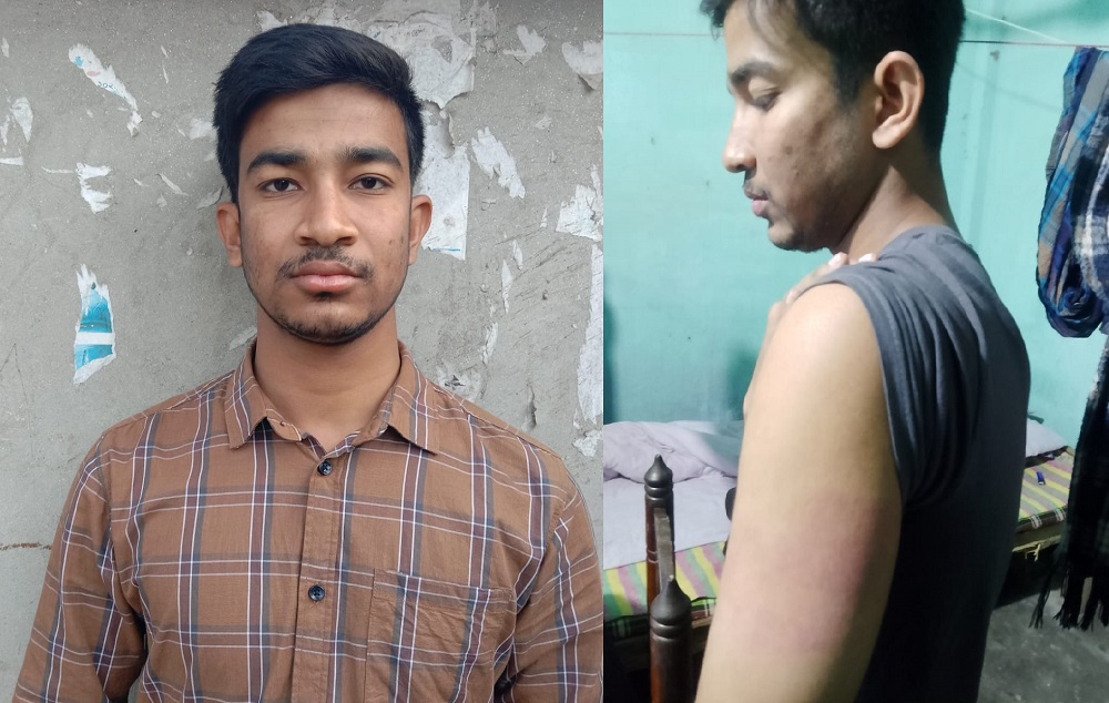 নওগাঁর মান্দায় যুবককে পিটিয়ে জখম