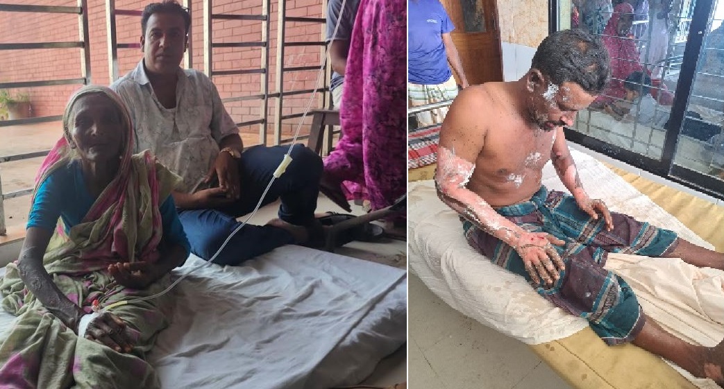 নওগাঁয় মাদক মামলার সাক্ষীর গায়ে পেট্রোল ঢেলে আগুন দিল জামিনপ্রাপ্ত আসামি