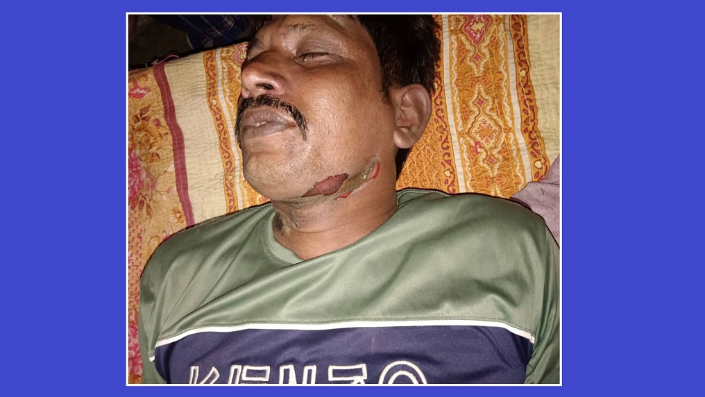 বাড়ির উঠান থেকে অটোরিকশাচালকের ক্ষতবিক্ষত মরদেহ উদ্ধার
