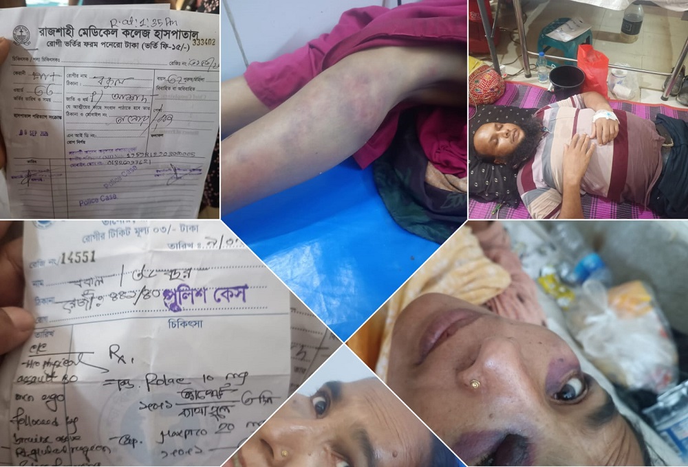 তানোরে প্রকাশ্যে হামলা, ছিনতাই ও প্রাণনাশের হুমকি