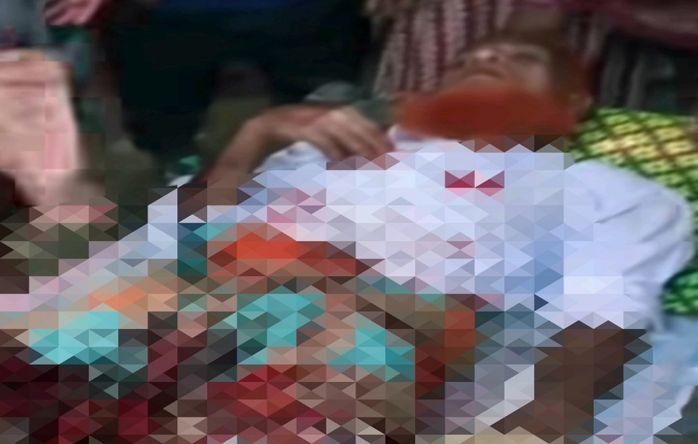 চাঁপাইনবাবগঞ্জের শিবগঞ্জে বন্য শুকরের আক্রমণে ৪জন আহত